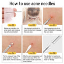 1/11Pcs Acne Pimples Blackhead Remover Clip Ultra-fine Tweezers Black Dots Blackhead Extractor Acne Needle Facial Cleaner Skin
